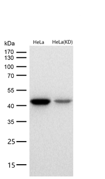 alpha smooth muscle Actin Rabbit mAb [KD Validated]
