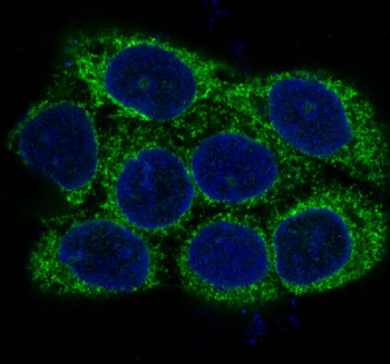 alpha smooth muscle Actin Rabbit mAb [KD Validated]