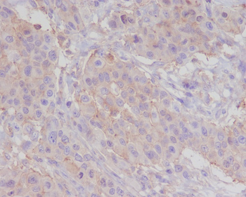 alpha smooth muscle Actin Rabbit mAb [KD Validated]