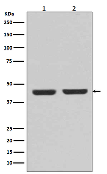 alpha smooth muscle Actin Rabbit mAb [KD Validated]