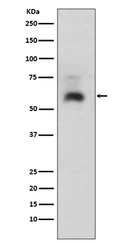 Smad1 Rabbit mAb
