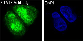 STAT3 Rabbit mAb [KD Validated]