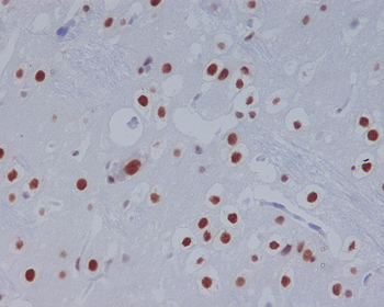 STAT3 Rabbit mAb [KD Validated]