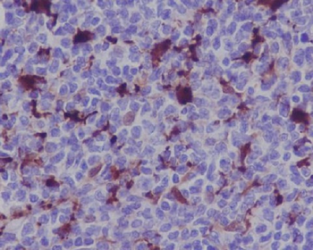 MERTK Rabbit Monoclonal Antibody