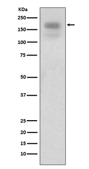 MERTK Rabbit Monoclonal Antibody