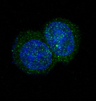 JAK2 Rabbit mAb Antibody
