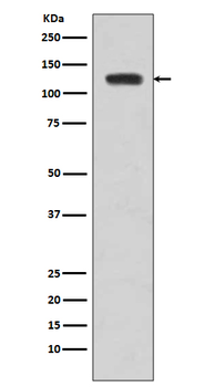 JAK2 Rabbit mAb Antibody