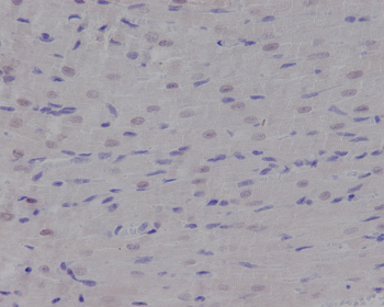p95/NBS1 Rabbit mAb Antibody