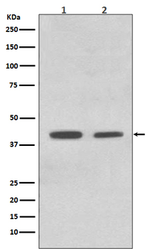 ACADM Rabbit mAb Antibody