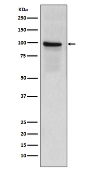 Thrombomodulin Rabbit mAb Antibody