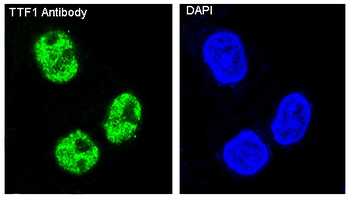 TTF1 Rabbit mAb Antibody