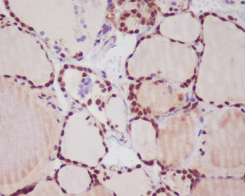 TTF1 Rabbit mAb Antibody
