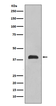 TTF1 Rabbit mAb Antibody