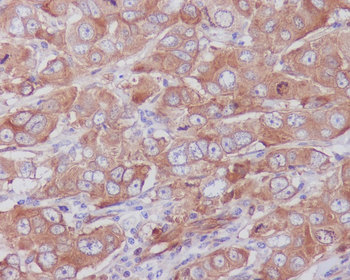 Paxillin Rabbit mAb Antibody