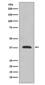 Synaptophysin Rabbit mAb