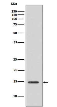 Histone H3 (acetyl K14) Rabbit mAb