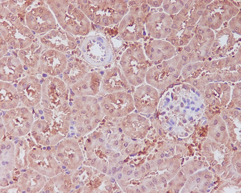 APAF1 Rabbit mAb Antibody