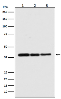 p38 MAPK Rabbit mAb [KD Validated]