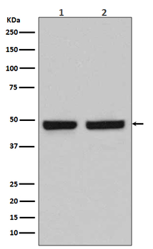 HAPLN1 Rabbit mAb