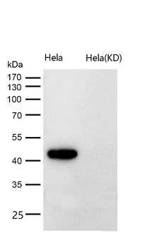 VASP Rabbit mAb [KD Validated] Antibody