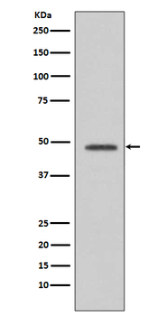 VASP Rabbit mAb [KD Validated] Antibody