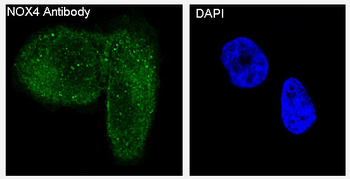 NOX4 Rabbit mAb Antibody