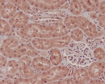 NOX4 Rabbit mAb Antibody