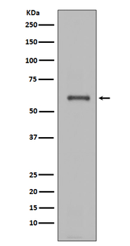 NOX4 Rabbit mAb Antibody