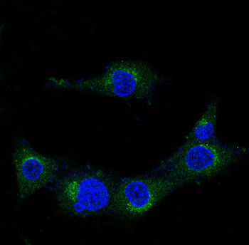Amyloid beta A4 Rabbit mAb  [KD Validated]