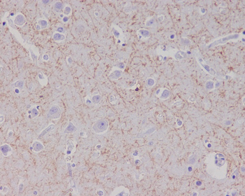 Amyloid beta A4 Rabbit mAb  [KD Validated]