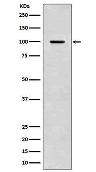 Amyloid beta A4 Rabbit mAb  [KD Validated]