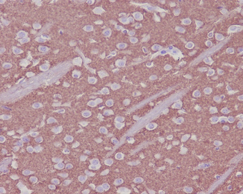 Synaptophysin Rabbit mAb