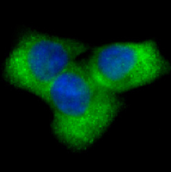 Notch1 Rabbit mAb Antibody