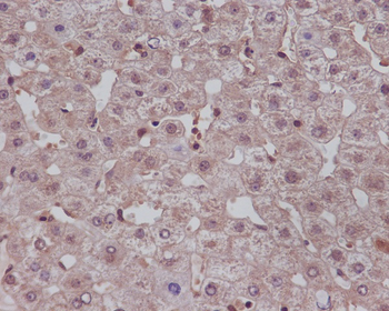 Notch1 Rabbit mAb Antibody