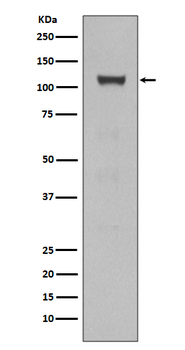 Notch1 Rabbit mAb Antibody