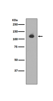 Neuropilin 1 Rabbit mAb