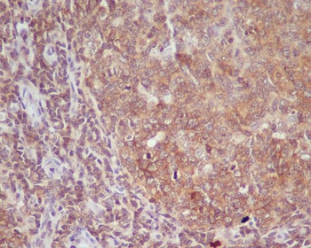 CD86 Rabbit mAb