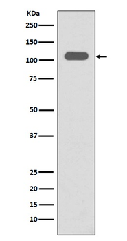 Integrin beta 3 Rabbit mAb Antibody