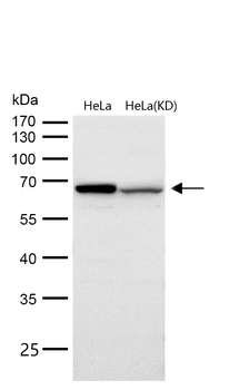 MMP14 Rabbit mAb [KD Validated] Antibody