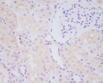 MMP14 Rabbit mAb  [KD Validated]