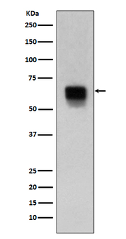 MMP14 Rabbit mAb  [KD Validated]