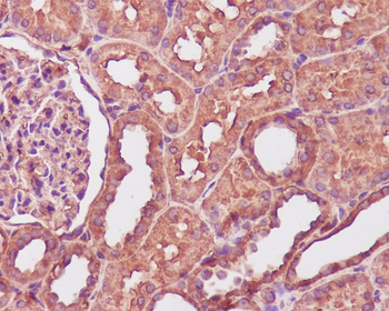 Calmodulin Rabbit mAb Antibody