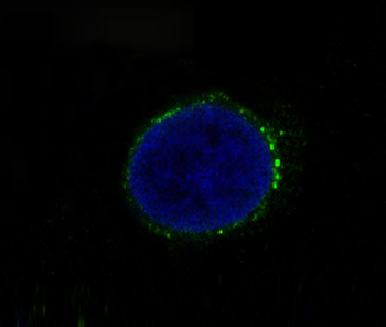 Met (c-Met) Rabbit mAb Antibody