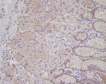 Met (c-Met) Rabbit mAb Antibody