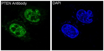 PTEN Rabbit mAb Antibody