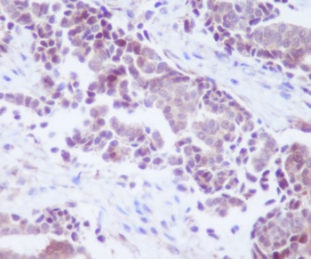 PTEN Rabbit mAb Antibody