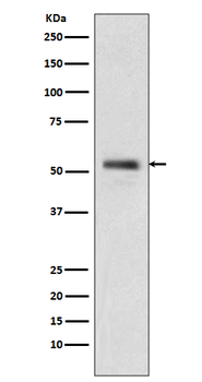 PTEN Rabbit mAb Antibody