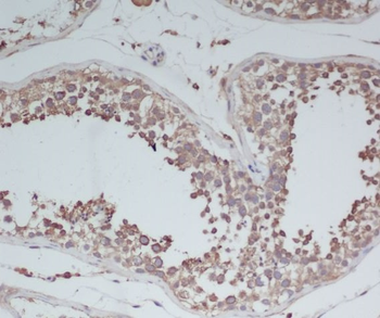BDNF Rabbit mAb   [KD Validated]