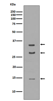BDNF Rabbit mAb   [KD Validated]