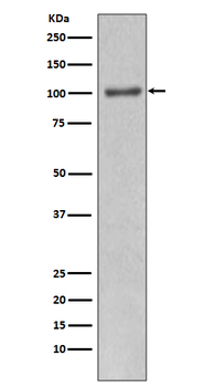 PI 3 kinase p110 alpha Rabbit Monoclonal Antibody